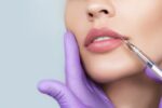 The Filler Fixation: Enhancing Facial Features & Restoring Youthfulness