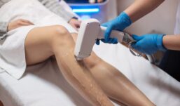 Woman receiving laser hair removal
