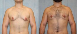 Gallery Image-5
