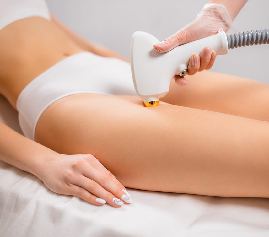 Woman receiving laser hair removal