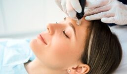 Woman receiving microneedling treatment