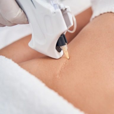examining a scar