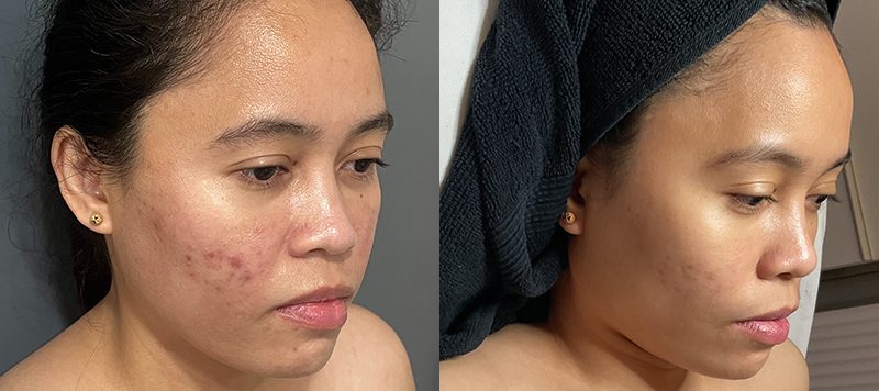 Skin Care Patient 2 Image 0