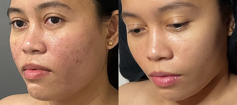 Skin Care Patient 2 Image 2