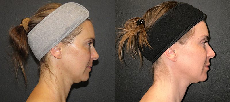 Skin Care Patient 3 Image 0