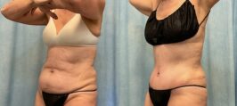 Gallery Image-18